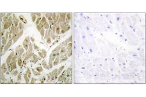 Immunohistochemistry analysis of paraffin-embedded human heart tissue, using API-5 Antibody.