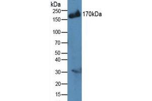 Western blot analysis of Human MCF7 Cells. (IRS2 anticorps  (AA 985-1255))