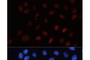 Immunofluorescence analysis of U-2 OS cells using SUMO1 Polyclonal Antibody at dilution of 1:100. (SUMO1 anticorps)