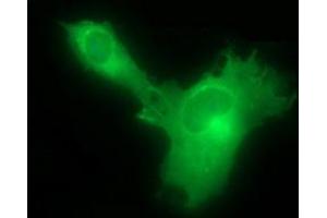 Immunofluorescence (IF) image for anti-Hydroxysteroid (17-Beta) Dehydrogenase 4 (HSD17B4) antibody (ABIN2715561) (HSD17B4 anticorps)