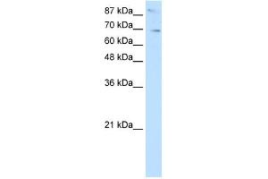WB Suggested Anti-SKIL Antibody Titration:  2. (SKIL anticorps  (N-Term))