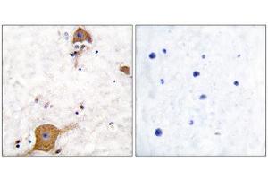Immunohistochemistry (IHC) image for anti-Neuregulin 1 (NRG1) (Isoform 10), (N-Term) antibody (ABIN6299311) (Neuregulin 1 anticorps  (Isoform 10, N-Term))