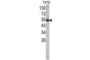 Image no. 1 for anti-Eukaryotic Translation Elongation Factor 1 alpha 1 (EEF1A1) (N-Term) antibody (ABIN452936) (eEF1A1 anticorps  (N-Term))