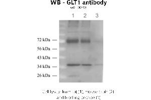 Image no. 1 for anti-Solute Carrier Family 1 (Glial High Affinity Glutamate Transporter), Member 2 (SLC1A2) (C-Term) antibody (ABIN346978) (SLC1A2 anticorps  (C-Term))