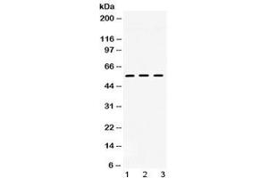 Western blot testing of 1) rat heart, 2) mouse liver and 3) human HeLa lysate with TGF beta receptor I antibody at 0.