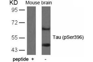 Image no. 1 for anti-Microtubule-Associated Protein tau (MAPT) (pSer396) antibody (ABIN196791) (MAPT anticorps  (pSer396))