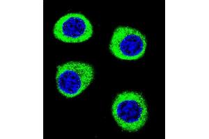 Confocal immunofluorescent analysis of CPSF3L Antibody (N-term) (ABIN655113 and ABIN2844744) with U-251MG cell followed by Alexa Fluor 488-conjugated goat anti-rabbit lgG (green). (CPSF3L anticorps  (N-Term))