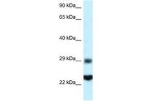 Image no. 1 for anti-Ribosomal Protein S9 (RPS9) (C-Term) antibody (ABIN6747457) (RPS9 anticorps  (C-Term))