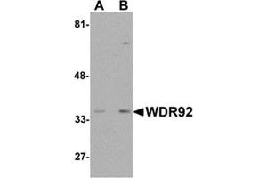 Western blot analysis of WDR92 in human kidney tissue lysate with WDR92 antibody at (A) 1 and (B) 2 μg/ml. (WDR92 anticorps  (Center))