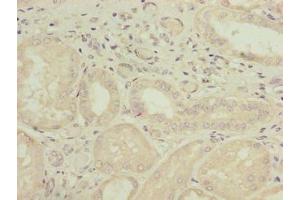 Immunohistochemistry of paraffin-embedded human kidney tissue using ABIN7163868 at dilution of 1:100 (GALNT14 anticorps  (AA 35-335))