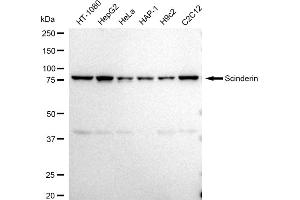 Western blotting analysis using Scinderin antibody (ABIN7800278).
