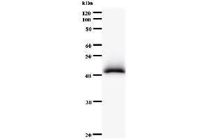 Western Blotting (WB) image for anti-PDS5, Regulator of Cohesion Maintenance, Homolog B (PDS5B) antibody (ABIN931004) (PDS5B anticorps)
