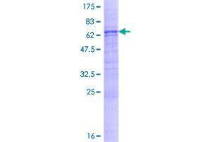Image no. 1 for Asporin (ASPN) (AA 1-384) protein (GST tag) (ABIN1345884)