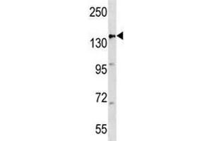APC antibody western blot analysis in mouse heart tissue lysate