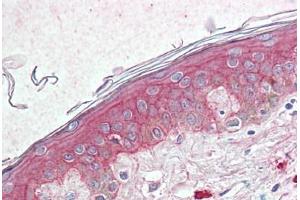 Anti-TSPAN6 antibody  ABIN960831 IHC staining of human skin.