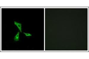Immunofluorescence analysis of HeLa cells, using GPR101 Antibody. (GPR101 anticorps  (C-Term))