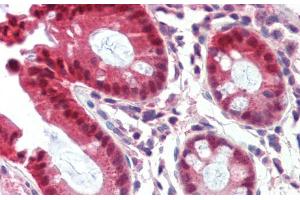Immunohistochemistry with Human Colon lysate tissue at an antibody concentration of 5. (NR1I3 anticorps  (Middle Region))