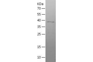 Western Blotting (WB) image for Transcription Factor MafF (MAFF) (AA 1-164) protein (His-IF2DI Tag) (ABIN7125449)