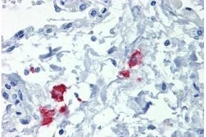 Lung, Human: Formalin-Fixed, Paraffin-Embedded (FFPE)