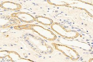 Immunohistochemistry analysis of paraffin-embedded mouse kidney using,TMEM213 (ABIN7075999) at dilution of 1: 2000 (TMEM213 anticorps)