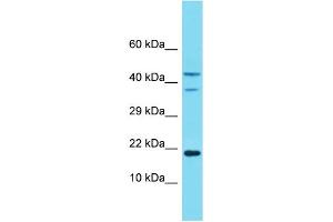 Western Blotting (WB) image for anti-NADH Dehydrogenase (Ubiquinone) 1 alpha Subcomplex, 8, 19kDa (NDUFA8) (Middle Region) antibody (ABIN2774343) (NDUFA8 anticorps  (Middle Region))