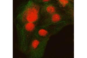 IF analysis of SNRNP200 and Tubulin beta using anti-SNRNP200 antibody (ABIN7602032) and anti-Tubulin beta antibody (ABIN7602744).