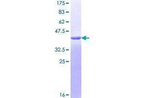 Image no. 1 for PYD and CARD Domain Containing (PYCARD) (AA 1-149) protein (GST tag) (ABIN1316968)