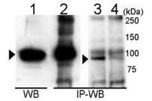 Immunoprecipitation and Western blot analysis of anti-UVRAG Antibody  in 293T cells. (UVRAG anticorps  (C-Term))