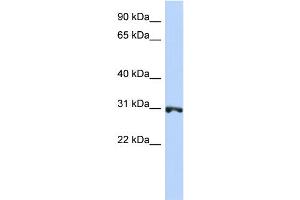 WB Suggested Anti-RNF126 Antibody Titration:  0. (RNF126 anticorps  (N-Term))