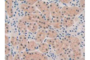 IHC-P analysis of Rat Kidney Tissue, with DAB staining. (OIT3 anticorps  (AA 251-524))