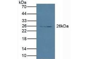 Detection of PRSS2 in Porcine Pancreas lysate using Polyclonal Antibody to Protease, Serine 2 (PRSS2) (PRSS2 anticorps  (AA 24-241))