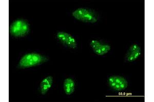 Immunofluorescence of purified MaxPab antibody to NOL14 on HeLa cell. (Nop14 anticorps  (AA 1-806))