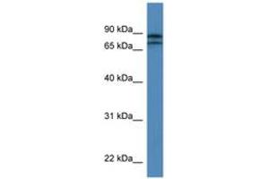 Image no. 1 for anti-Kelch-Like 22 (KLHL22) (AA 175-224) antibody (ABIN6746879) (KLHL22 anticorps  (AA 175-224))