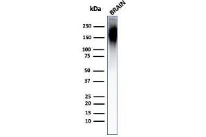 anti-Neurofilament, Heavy Polypeptide (NEFH) antibody