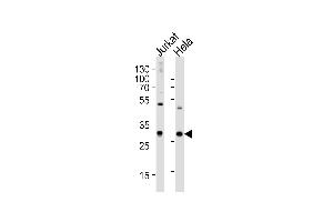 Western blot analysis of lysates from Jurkat, HeLa cell line (from left to right), using CZB Antibody (N-term) 2888a. (CAPZB anticorps  (N-Term))