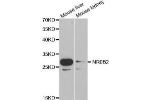 Western blot analysis of extracts of various cell lines, using NR0B2 antibody. (NR0B2 anticorps  (AA 1-257))