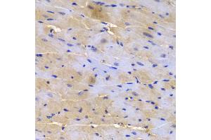 Immunohistochemistry of paraffin-embedded mouse heart using SGCE antibody (ABIN5973070) at dilution of 1/200 (40x lens). (SGCE anticorps)