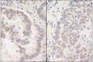 Immunohistochemistry (IHC) image for anti-Poly-U Binding Splicing Factor 60KDa (PUF60) (AA 400-450) antibody (ABIN7454869)