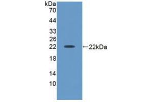 Western blot analysis of recombinant Human ACVA. (ACVA anticorps  (AA 44-178))