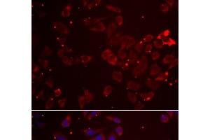 Immunofluorescence analysis of A549 cells using GATM Polyclonal Antibody (GATM anticorps)