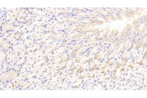 Detection of LIPC in Mouse Stomach Tissue using Polyclonal Antibody to Lipase, Hepatic (LIPC) (LIPC anticorps  (AA 159-415))