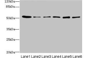 Western blot All lanes: ZNF398 antibody at 3 μg/mL Lane 1: 293T whole cell lysate Lane 2: Hela whole cell lysate Lane 3: HepG2 whole cell lysate Lane 4: Jurkat whole cell lysate Lane 5: Caco-2 whole cell lysate Lane 6: A549 whole cell lysate Secondary Goat polyclonal to rabbit IgG at 1/10000 dilution Predicted band size: 72, 53 kDa Observed band size: 53 kDa (ZNF398 anticorps  (AA 401-642))
