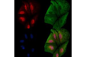ABIN6260386 and ABIN6279208 staining  cells by IF/ICC. (CABIN1 anticorps  (Internal Region))