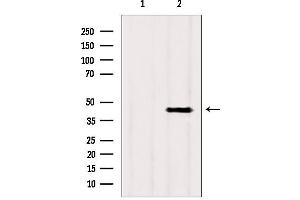 Western blot analysis of extracts from rat heart, using ACADS antibody. (ACADS anticorps)