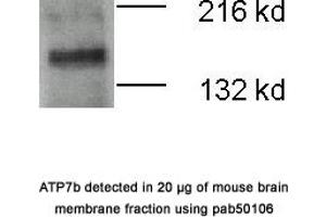 Image no. 1 for anti-ATPase, Cu++ Transporting, beta Polypeptide (ATP7B) (N-Term) antibody (ABIN363415)