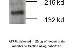 Image no. 1 for anti-ATPase, Cu++ Transporting, beta Polypeptide (ATP7B) (N-Term) antibody (ABIN363415) (ATP7B anticorps  (N-Term))