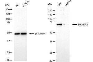 Western blotting analysis using RAVER2 antibody (ABIN7800211). (Recombinant RAVER2 anticorps)