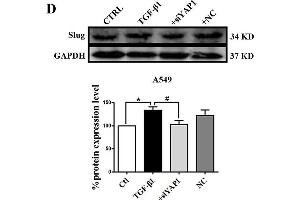 Slug is regulated by the co-transcriptional complex YAP1/TEAD in the EMT program of A549 cells. (GAPDH anticorps)