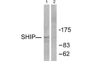 Western blot analysis of extracts from Jurkat cells, treated with PMA (1ng/ml, 15mins), using SHIP antibody (ABIN5976503). (INPP5D anticorps  (C-Term))