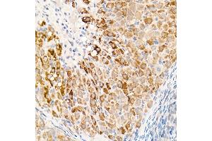Immunohistochemistry of paraffin-embedded rat ovary using OGDH Rabbit pAb (ABIN6131414, ABIN6145003, ABIN6145005 and ABIN6222018) at dilution of 1:25 (40x lens). (alpha KGDHC anticorps  (AA 148-427))
